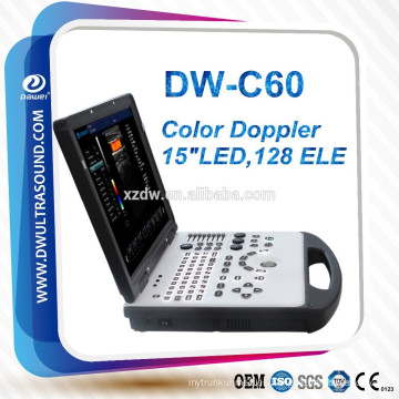 sistema pc escáner de ultrasonido doppler color DW-C60 marca DAWEI y escáner de ultrasonido Doppler color portátil de pantalla de 15 pulgadas LED